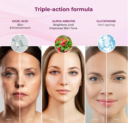 Kozicare Skin Lightening Soap